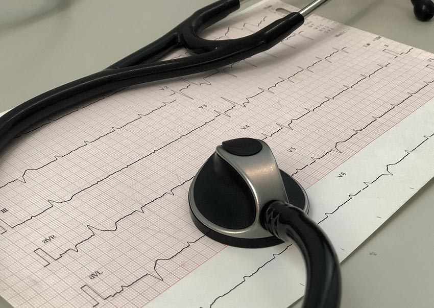 ECG - Electrocardiogramme pour connaître votre rythme cardiaque